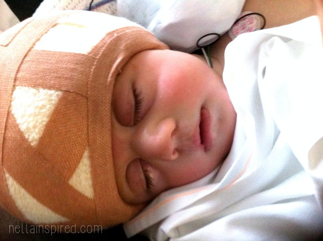 In paediatric intensive care unit after his first cranial vault reconstruction in 2013